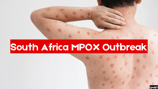 South Africa MPOX Outbreak